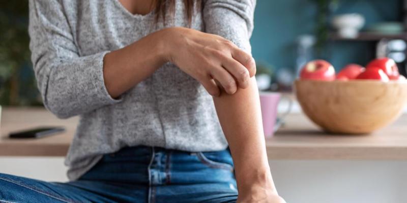 Skin condition woman scratching arm